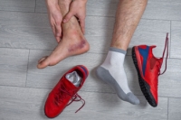 Facts About Acute Ankle Sprains