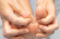 What Are the Causes and Symptoms of Athlete’s Foot?